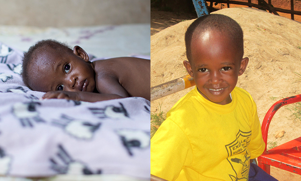 Morris from Uganda, Children's Heart Project