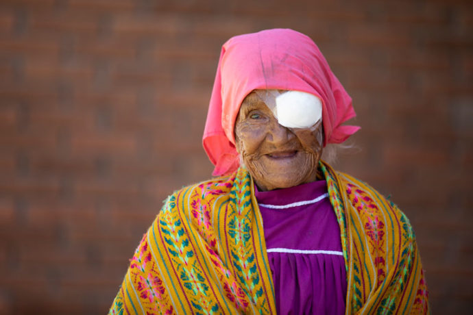 Cataract surgery patient in Mexico