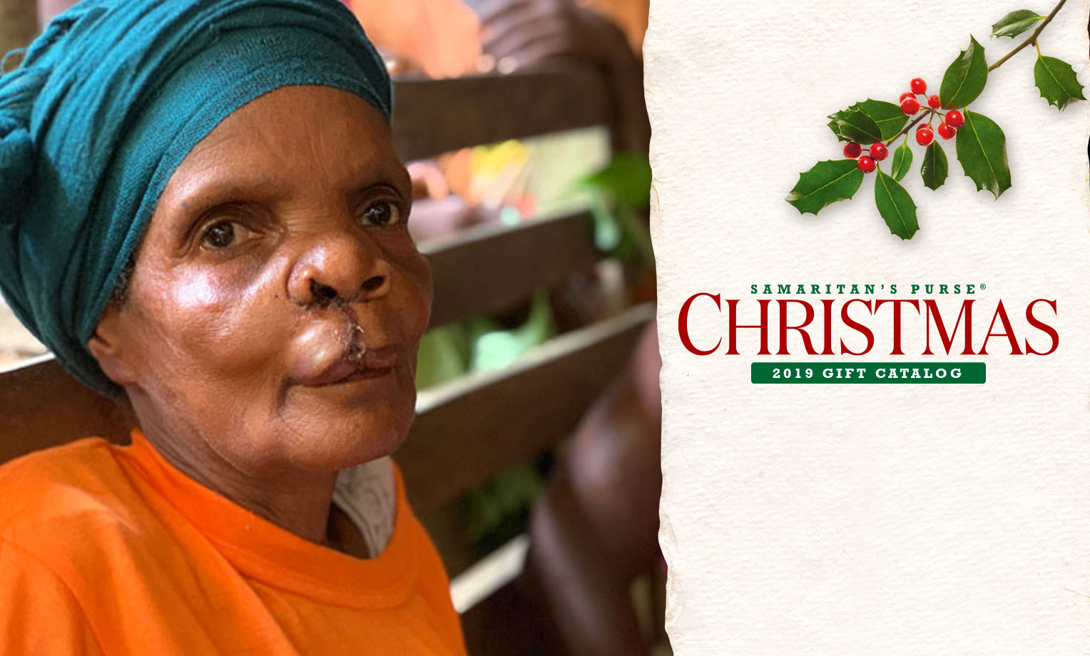 Samaritan's Purse provides life-changing cleft lip-palete surgeries in communities all over the world.