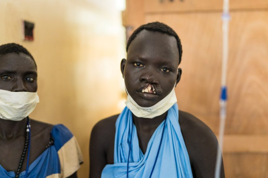 Santina, 18, had endured ridicule and shame because of her cleft lip.