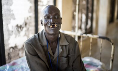 South Sudan cleft lip