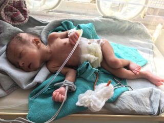Baby Sherin is growing healthier after her surgery. 